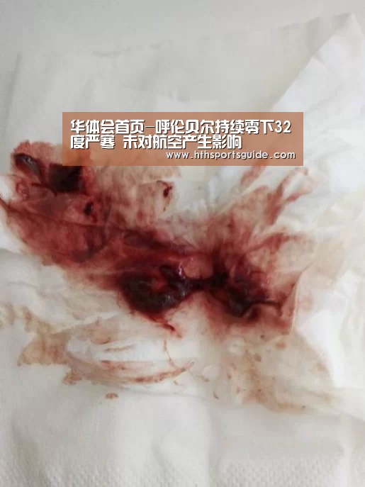 华体会首页-呼伦贝尔持续零下32度严寒 未对航空产生影响(图4) 华体会首页-呼伦贝尔持续零下32度严寒 未对航空产生影响(图4)